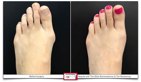 cute toes vs ugly.